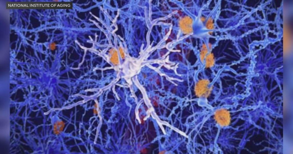 Expert emphasizes how metabolism and lifestyle choices today can predict brain health in older age Expert emphasizes how metabolism and lifestyle choices today can predict brain health in older age