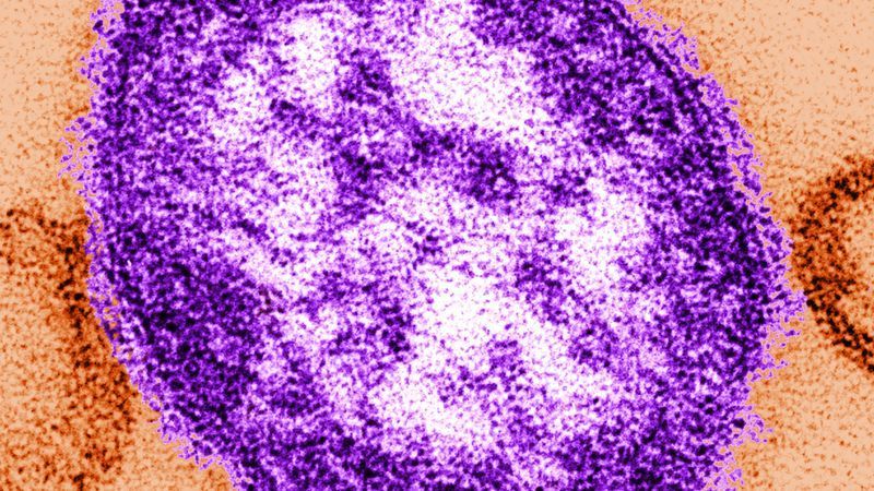 FILE: In this handout from the Centers for Disease Control and Prevention (CDC), a thin-section transmission electron micrograph (TEM) reveales the ultrastructural appearance of a single virus particle, or "virion", of measles virus. in this undated image. (Photo by CDC via Getty Images)
