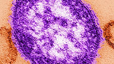 In this handout from the Centers for Disease Control and Prevention (CDC), a thin-section transmission electron micrograph (TEM) reveales the ultrastructural appearance of a single virus particle, or "virion", of measles virus. in this undated image. (Photo by CDC via Getty Images)