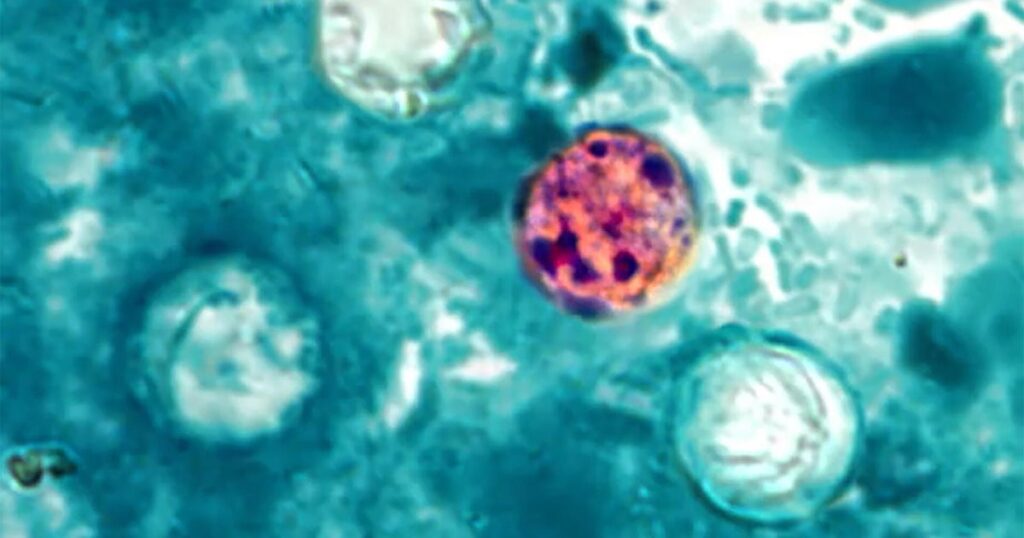 Michigan health officials urge residents to keep eating fresh produce as cyclosporiasis outbreak continues