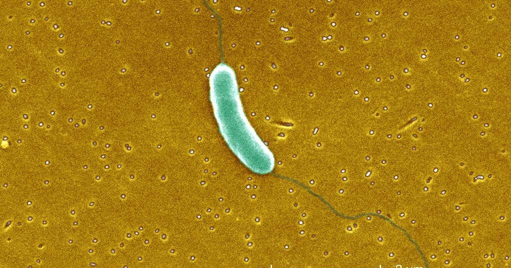 Flesh-eating bacteria has killed 5 in Louisiana this year, officials say Flesh-eating bacteria has killed 5 in Louisiana this year, officials say
