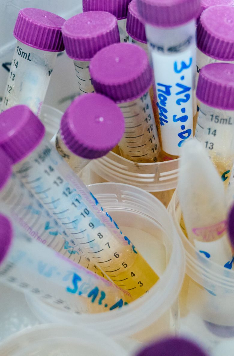 Modern urinalysis started in the 19th century, and allowed for a much more thorough understanding of a patient's health.