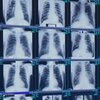 New federal safety rules on silica dust aim to protect miners' lungs